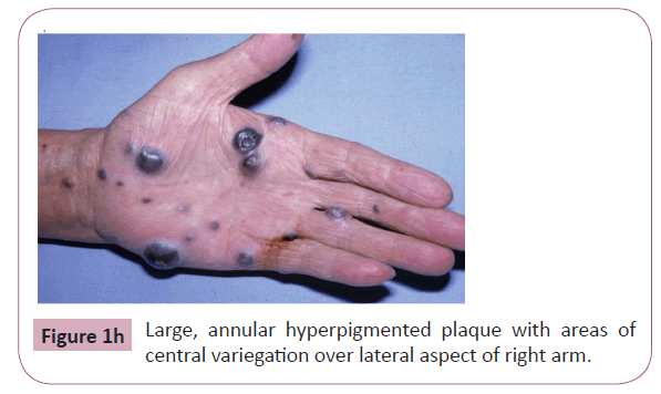 annals-clinical-laboratory-over-lateral