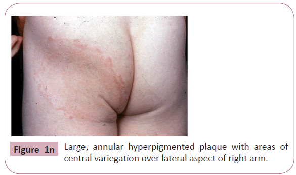 annals-clinical-laboratory-over-lateral