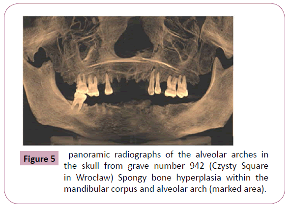 annals-clinical-laboratory-panoramic-radiographs