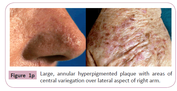 annals-clinical-laboratory-plaque