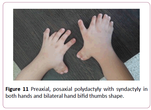 annals-clinical-laboratory-posaxial