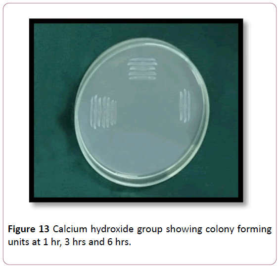 annals-clinical-laboratory-research-Calcium-hydroxide