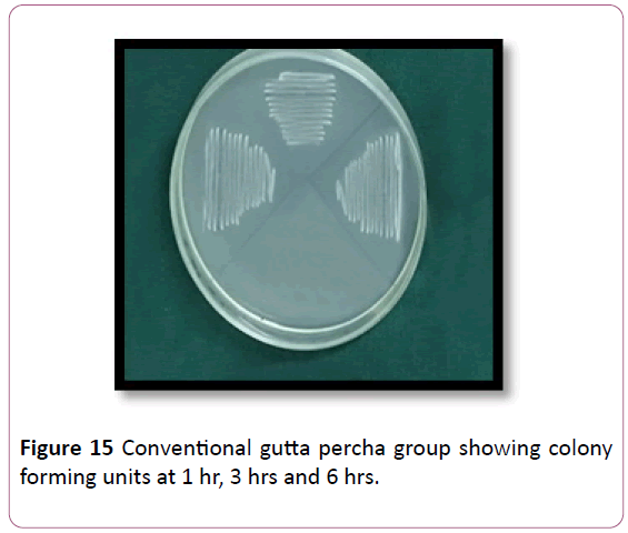 annals-clinical-laboratory-research-Conventional-gutta