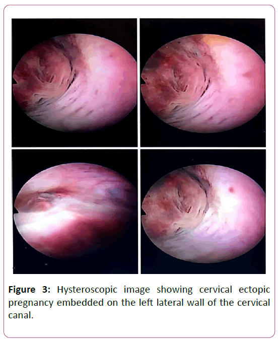 annals-clinical-laboratory-research-hysteroscopic-image