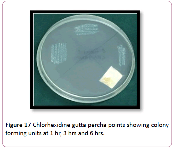 annals-clinical-laboratory-research-percha-points
