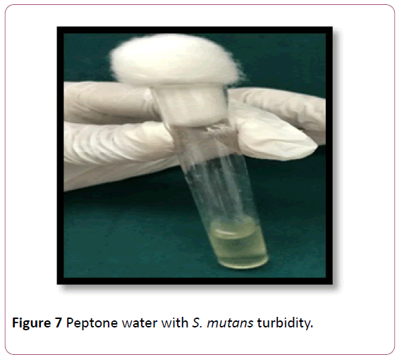 annals-clinical-laboratory-research-turbidity