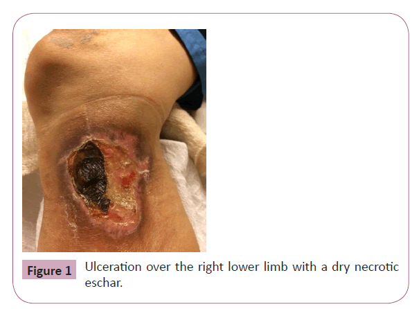 annals-clinical-laboratory-right-lower-limb