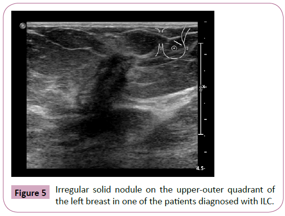 annals-clinical-laboratory-solid-nodule