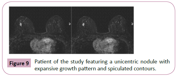 annals-clinical-laboratory-spiculated-contours