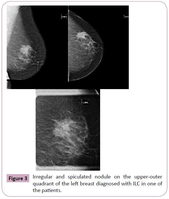 annals-clinical-laboratory-spiculated-nodule