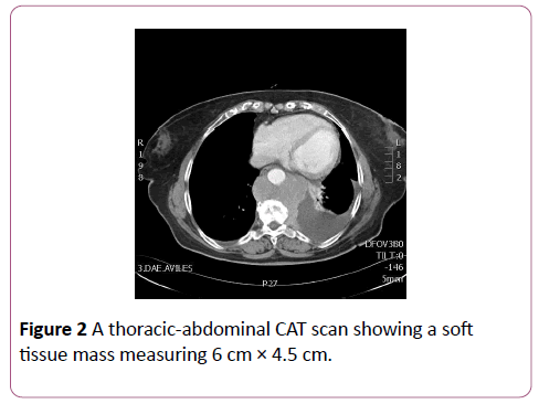 annals-clinical-laboratory-thoracic-abdominal