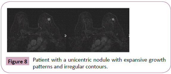 annals-clinical-laboratory-unicentric-nodule