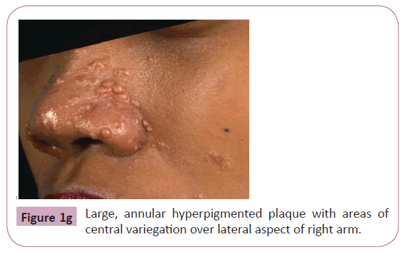 annals-clinical-laboratory-variegation-over