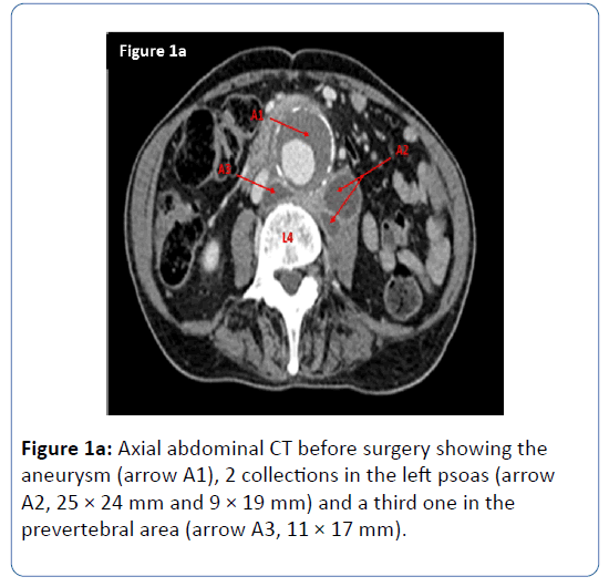 archives-medicine-Axial-abdominal