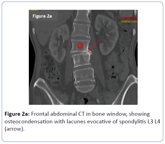 archives-medicine-Frontal-abdominal