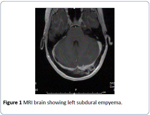 archives-medicine-MRI-brain