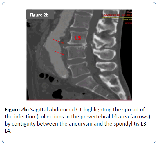 archives-medicine-Sagittal-abdominal