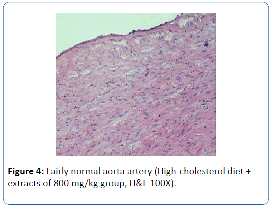 archives-medicine-aorta-artery