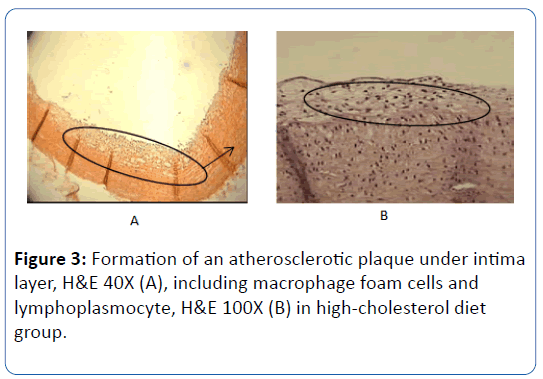 archives-medicine-atherosclerotic