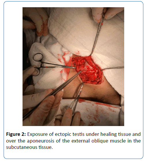 archives-medicine-ectopic-testis