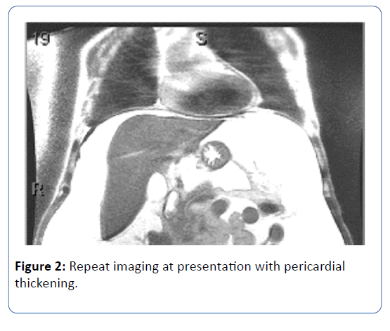 archives-medicine-pericardial
