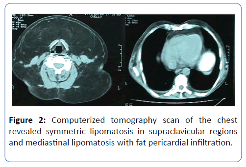 archives-medicine-supraclavicular-regions