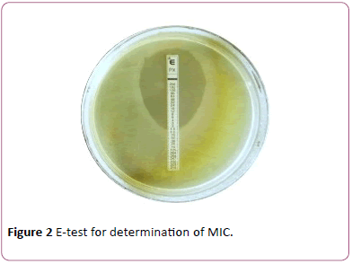 archives-of-clinical-microbiology-E-test