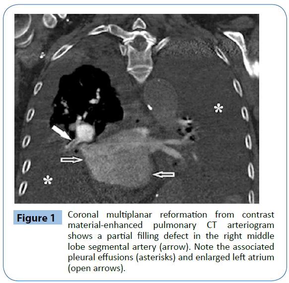 archivesofmedicine-Coronal-multiplanar-reformation