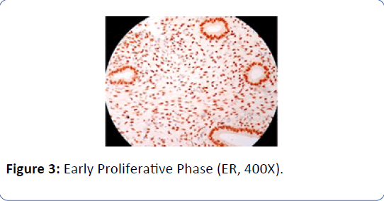 archivesofmedicine-Early-Proliferative