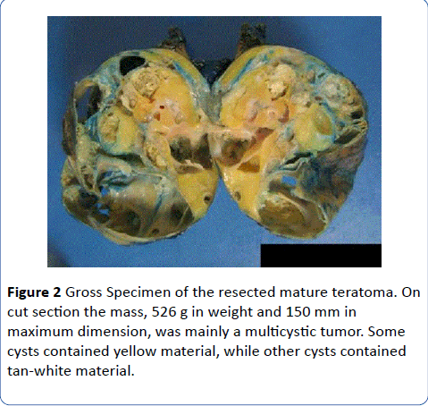 archivesofmedicine-Gross-Specimen