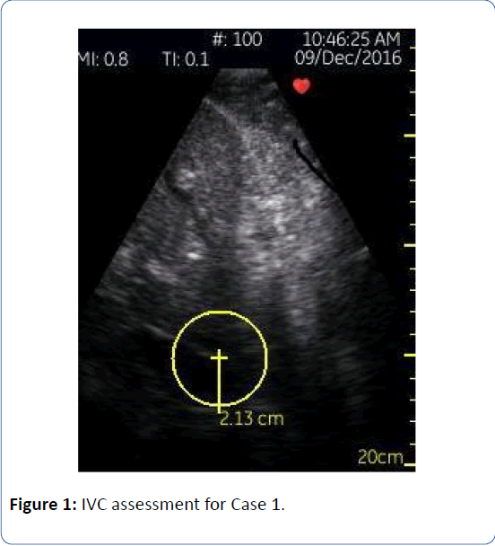 archivesofmedicine-IVC-assessment