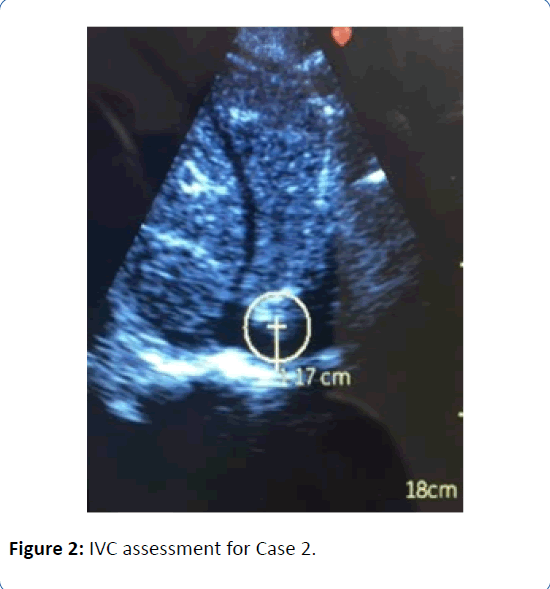 archivesofmedicine-IVC-assessment