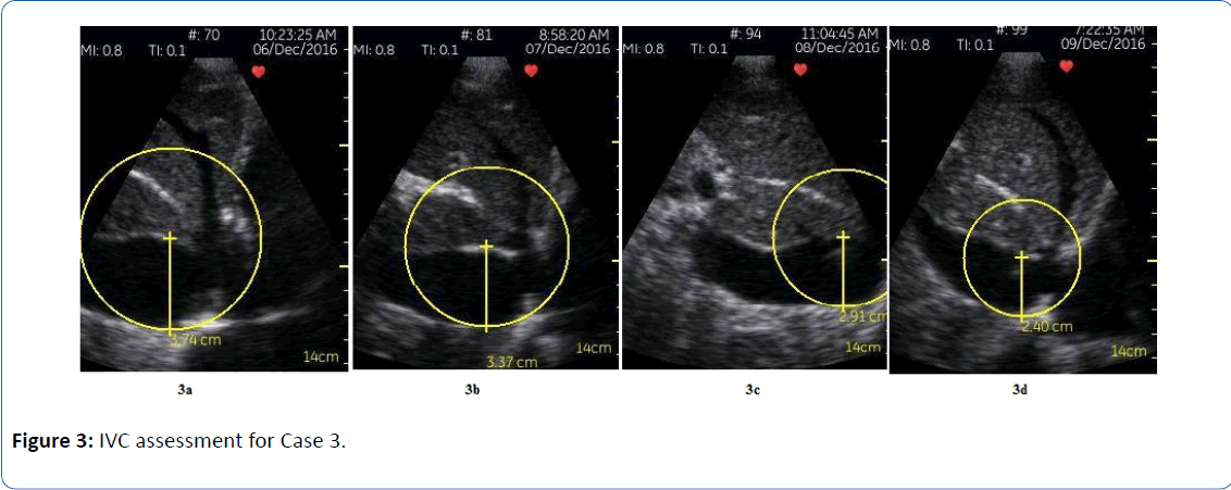 archivesofmedicine-IVC-assessment