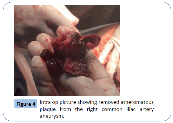 archivesofmedicine-Intra-op-picture