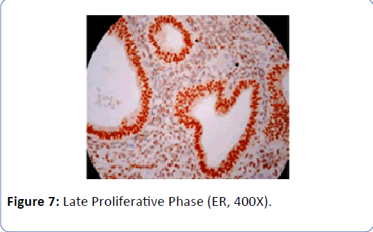 archivesofmedicine-Late-Proliferative