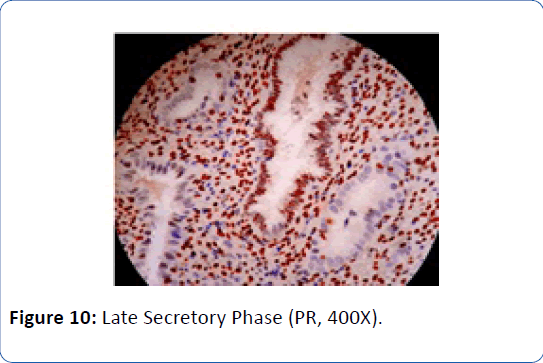 archivesofmedicine-Late-Secretory