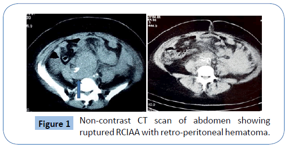 archivesofmedicine-Non-contrast-CT-scan