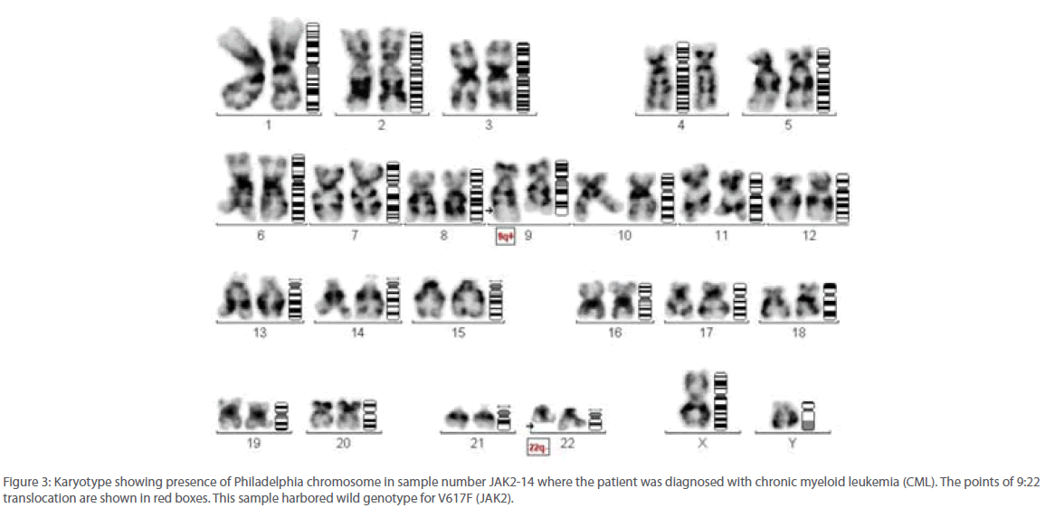 archivesofmedicine-Philadelphia-chromosome