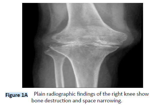 archivesofmedicine-Plain-radiographic-findings