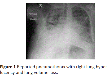 archivesofmedicine-Reported-pneumothorax