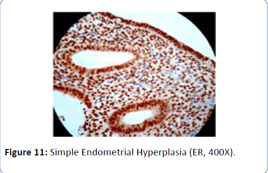 archivesofmedicine-Simple-Endometrial