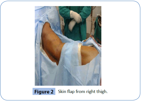 archivesofmedicine-Skin-flap