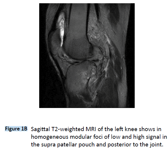 archivesofmedicine-T2-weighted-MRI