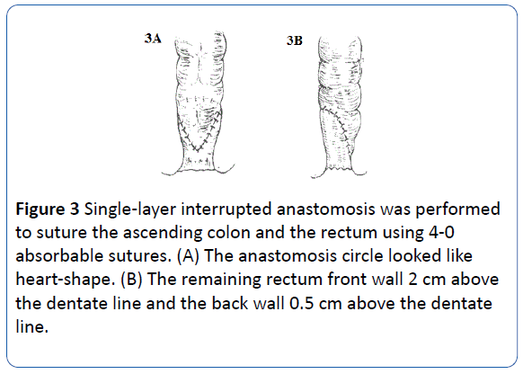 archivesofmedicine-absorbable-sutures