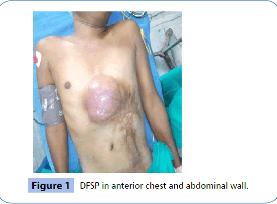 archivesofmedicine-anterior-chest