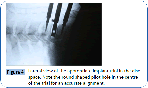 archivesofmedicine-appropriate-implant