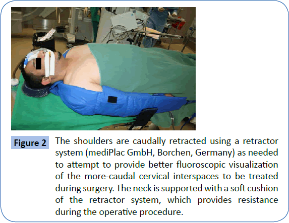 archivesofmedicine-caudally-retracted