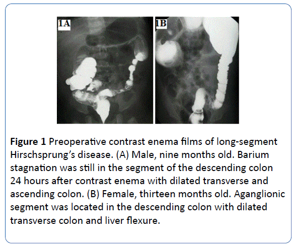 archivesofmedicine-descending-colon