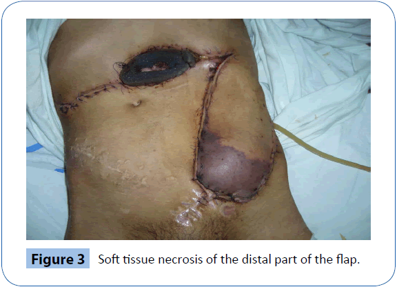 archivesofmedicine-distal-part