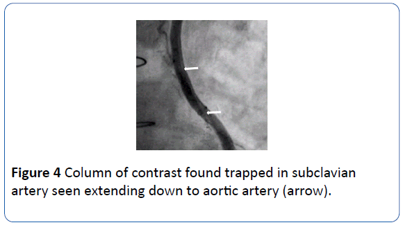 archivesofmedicine-down-aortic-artery